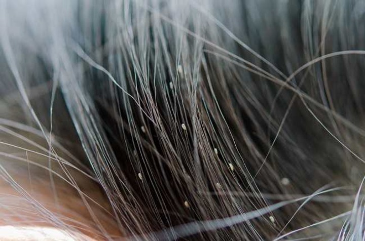 10 Manfaat Air Beras Untuk Kecantikan Wajah Dan Rambut 10 Manfaat Air Beras Untuk Kecantikan Wajah Dan Rambut