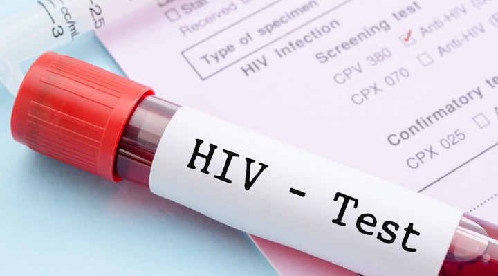 Penularan Virus HIV dan Hepatitis