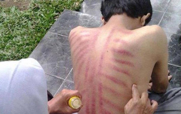 Kerokan Membuat Seseorang Ketagihan