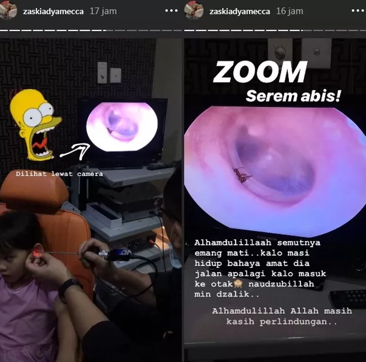 Anak Zaskia Adya Mecca Kemasukan Semut