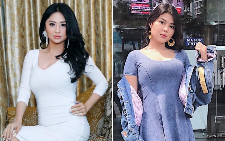 Dewi Persik Cantik Alami, Keponakan Dibully Soal Wajah Asli Sebelum Terkenal Hingga Aib Ketiak Basah