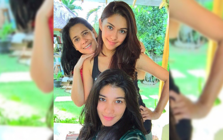 Dibandingkan dengan Naysila Mirdad, Nana Mirdad Dituduh Oplas Punya Pipi Tirus