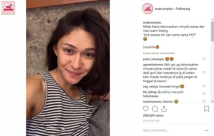 Paha Nana Mirdad Ketumpahan Minyak Panas