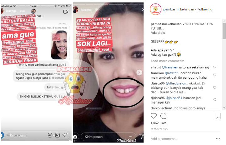 Ely Sugigi Dihina Gigi Busuk