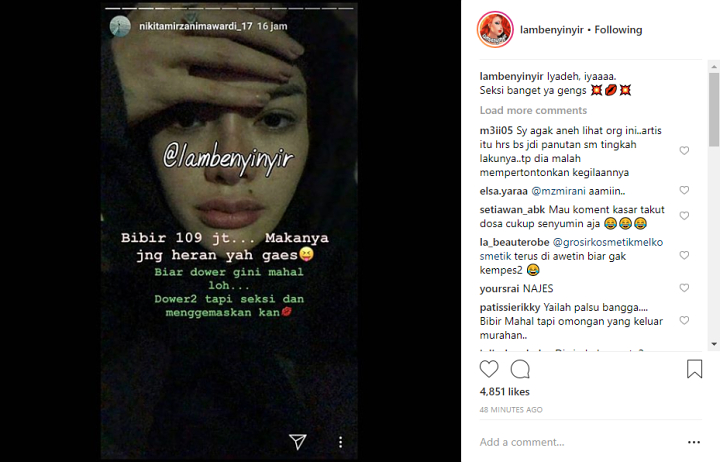 Nikita Mirzani Pamer Bibir Ndowe RP 109 Juta