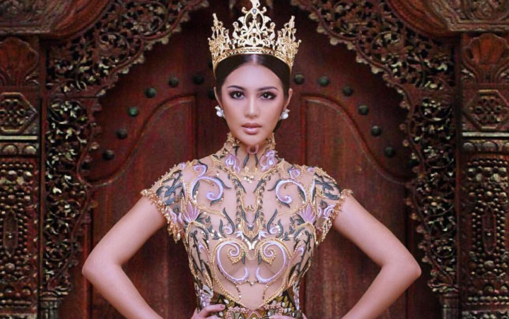 Ariska Putri Pertiwi Segera Dilamar, Pamer Body Goals Bak Gitar Spanyol Lewat Gaun Cantik Ini