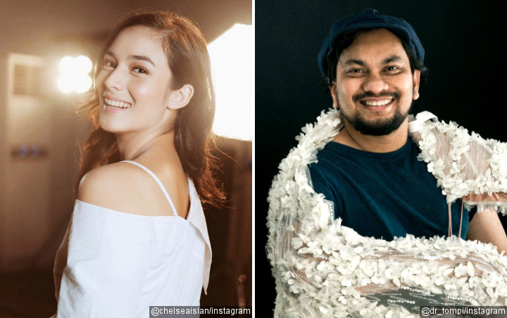 Chelsea Islan Cantik Kedipkan Mata, Begini Pendapat Tompi Sebagai Dokter