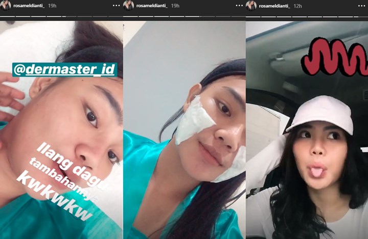 Keponakan Dewi Persik Perawatan