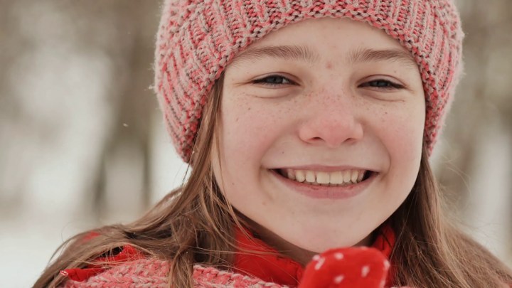 Tampilan Freckles Berubah Sesuai Musim