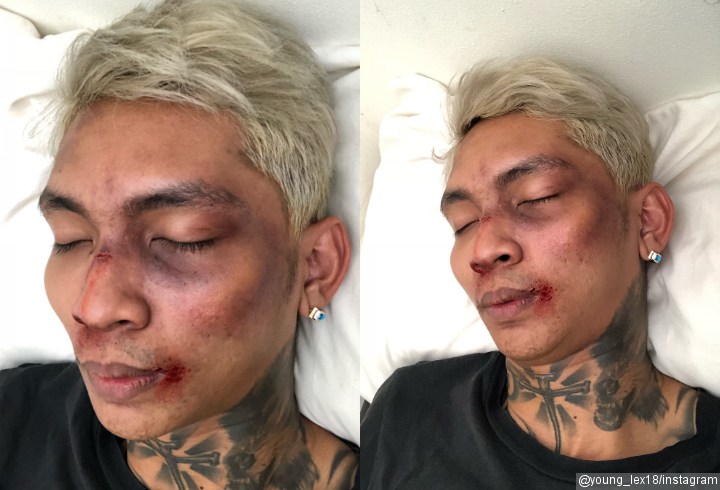 Hoaks Young Lex Ngaku Dipukuli Fans K-Pop Garis Keras