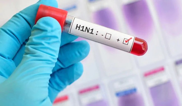 Bukan Penyakit Biasa, Kenali 6 Jenis Flu yang Berbahaya