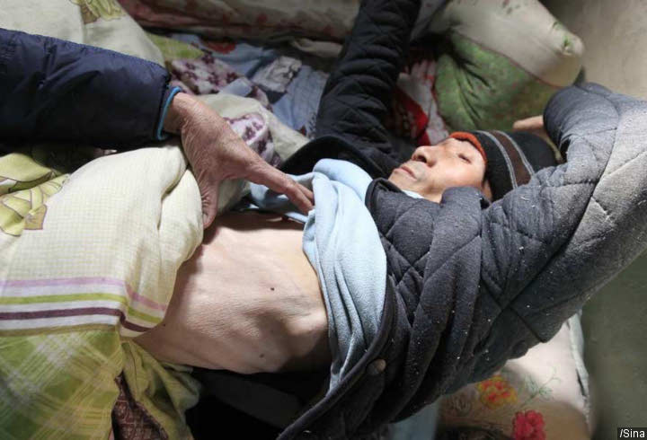 Kehilangan Berat Badan Meski Tidak Diet