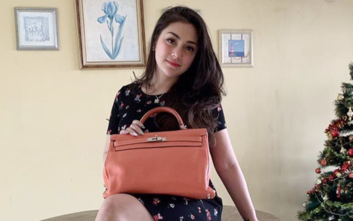 Jujur Pernah 'Liar' Sebelum Nikahi Stefan William, Wajah Cantik Celine Evangelista Bukti Bebas Oplas