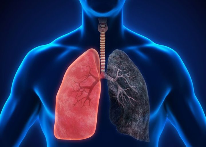 Kebiasaan Gunakan Vape dapat Mengakibatkan Kerusakan Paru-Paru