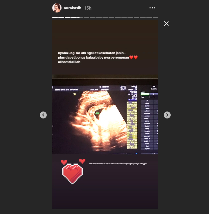 Jenis kelamin calon Bayi Aura Kasih, Perempuan