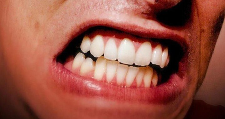 Kebiasaan Yang Membuat Gigi Terasa Sakit