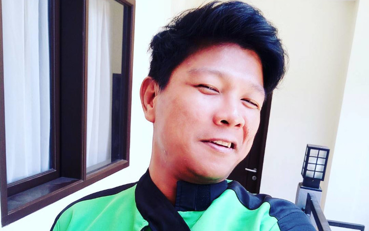 Andika Kangen Band Tolak Tawaran Endorse Operasi Plastik