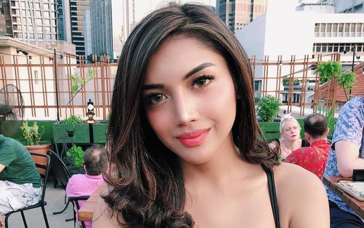Millendaru Adu 'Cantik' Dengan Wulan Guritno, Warna Gigi