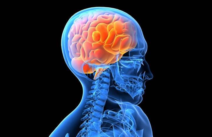 Melindungi Otak dari Penyakit Alzheimer