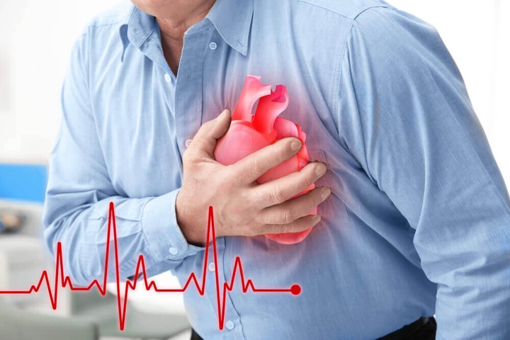 Manfaat Bawang Putih untuk Mencegah Penyakit Jantung