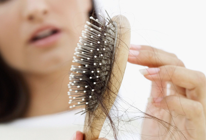 Stres Sebabkan Kerontokan Rambut