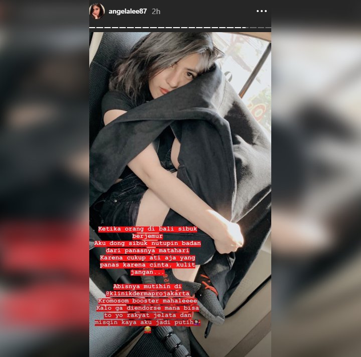 Alasan Angela Lee Ogah Kepanasan di Bali Lantaran Suntik Putih Mahal dan Hasil Endorse Dihujat