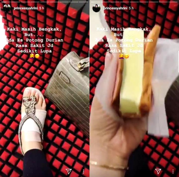Es Potong Durian Bikin Kaki Bengkak Syahrini Sembuh Gara-Gara Tertimpa Lemari Reino Barack