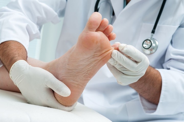 Penyebab Luka Diabetes Susah Sembuh