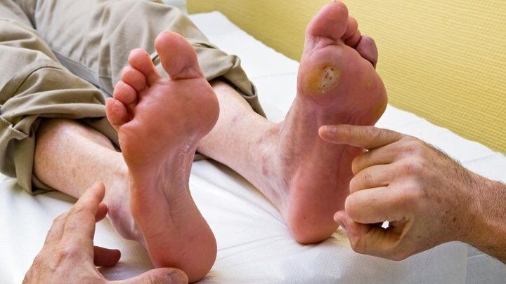 Periksakan Luka ke Dokter Jika Makin Parah