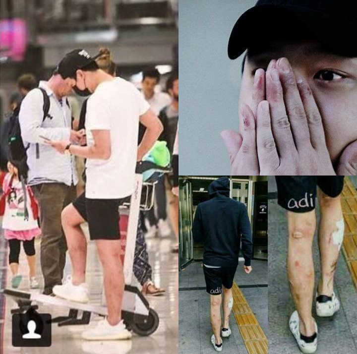 Ngotot Bantah Pakai Narkoba, Luka-Luka di Tangan dan Kaki Park Yoochun Jadi Bukti Kuat?