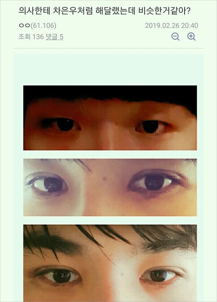 Cowok Korea Oplas Mata Agar Mirip Cha Eunwoo