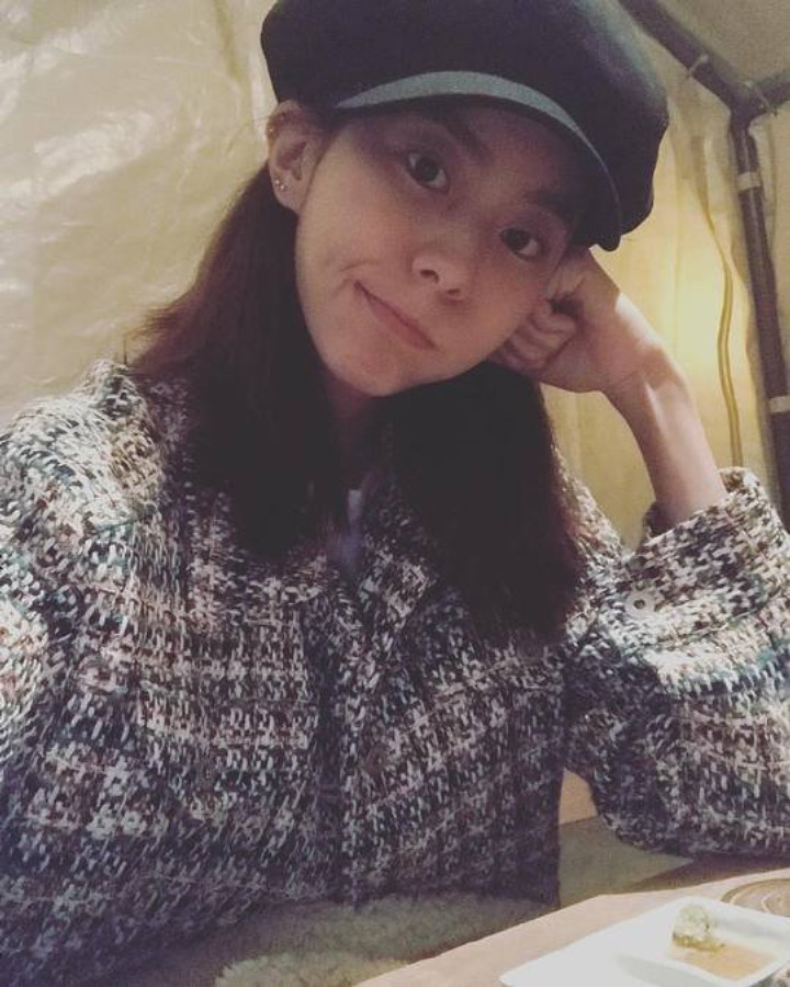 Uee Dikira Sakit Parah Gara-Gara Terlalu Kurus di Foto Terbaru