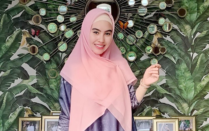 Berstatus Istri Habib, Foto Kartika Putri Pakai Kawat Gigi Hingga Kontak Lensa Tuai Pro Kontra