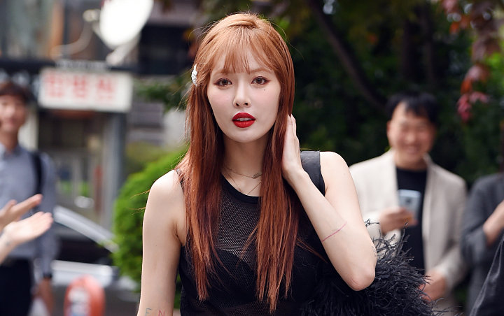 HyunA Dituduh Implan Payudara Usai Video Kostum Lepas Jadi Viral