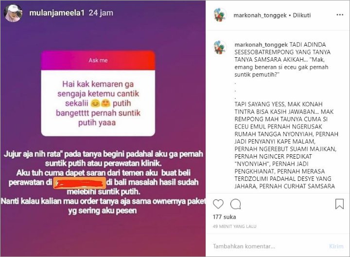 Instagram Suntik putih Mulan