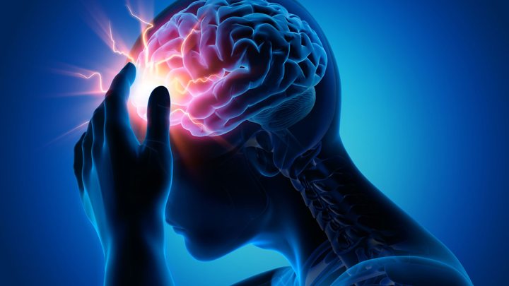 Hati-Hati Stroke!