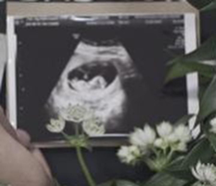Fitri Tropica Hamil Anak Pertama Usai 5 Tahun Menikah, Chacha Frederica Mewek Jadi Saksi