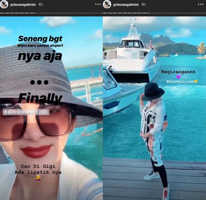 Noda di Gigi Syahrini