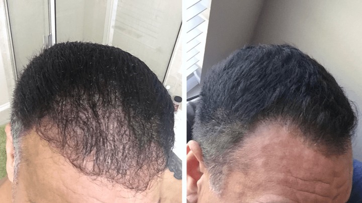 Lidah Buaya dapat Mempercepat Pertumbuhan Rambut