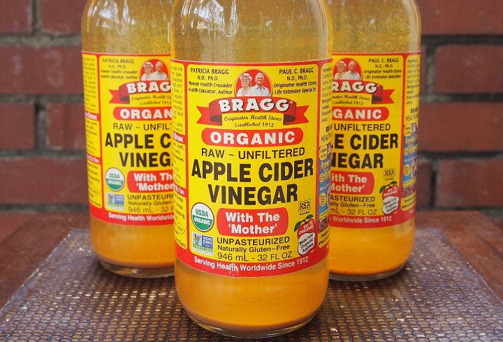 Gunakan Bragg Apple Cider Vinegar Secara Rutin Untuk Mengatasi Jerawat di Area Punggung