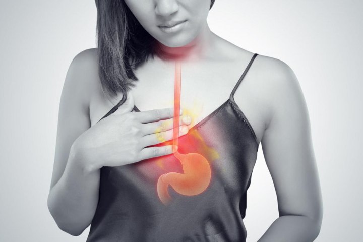 Hati-Hati, Makan Malam Terlalu Larut Bisa Menyebabkan Heartburn dan Acid Reflux