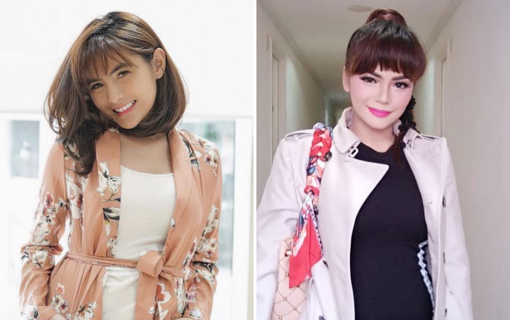 Angela Lee Pamer Luka Memar Jatuh Dari Tangga Komentar Khawatir Dinar Candy Disorot