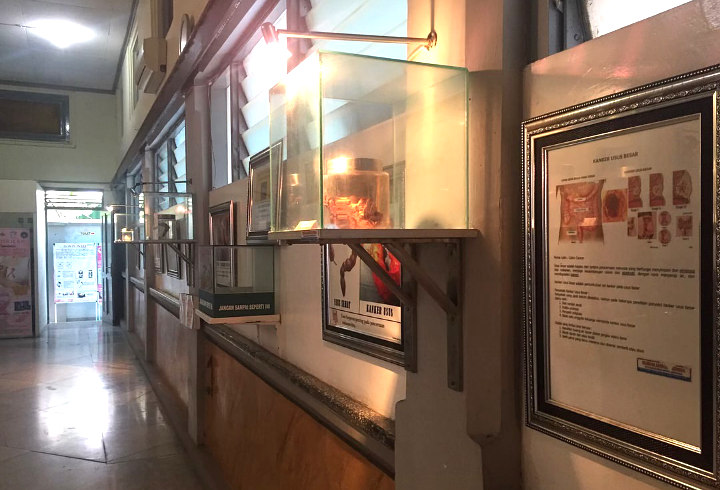 Museum Kanker Indonesia Yang Bakal Ajari Kalian Sejarah Kanker