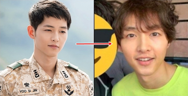 Foto Song Joong Ki Alami Kerontokan Rambut Drastis