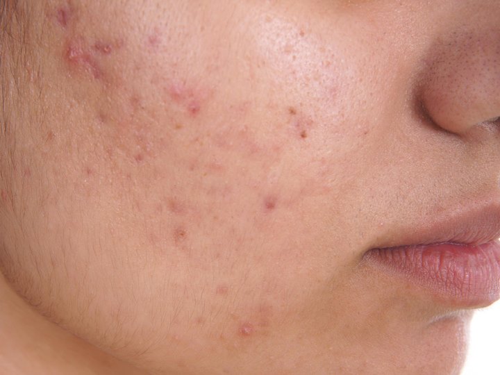8 Manfaat Baby Oil Untuk Kecantikan Wanita Aman Dan Murah 8 Manfaat Baby Oil Untuk Kecantikan Wanita Aman Dan Murah