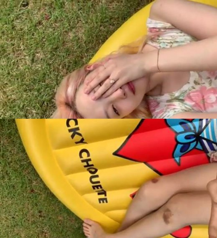 Memar di Lutut Sulli Bikin Netizen Berpikiran Mesum dan Aneh-Aneh