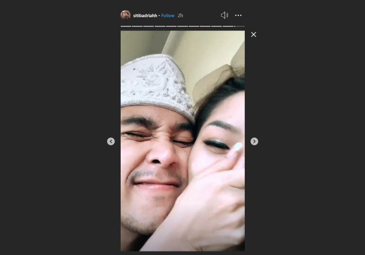 Sudah Resmi Menikah, Pipi Siti Badriah Langsung Digigit Suami