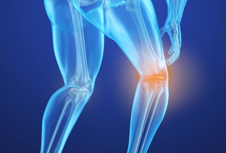 Malas Gerak Rupanya Juga Bisa Memicu Terjadinya Osteoporosis atau Pengeroposan Tulang