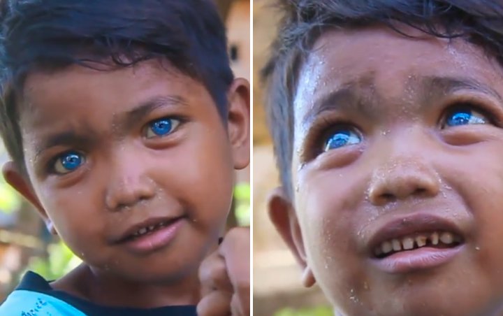 Bocah Asal Sulawesi Ini Bikin Heboh Karena Bermata Biru Indah bak Permata,  Netter Puji Habis-Habisan