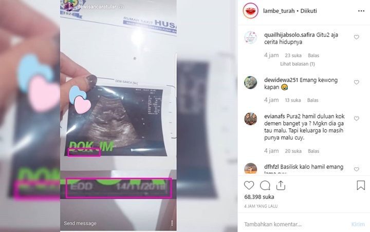 Foto USG Jadi Bahan Tertawaan Netizen, Calon Bayi Dewi Sanca Dibilang Kadaluarsa